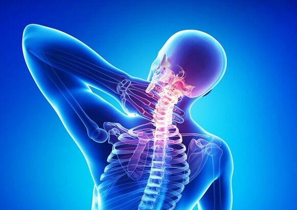 Schmerzen in der Halsspalte mit Osteochondose