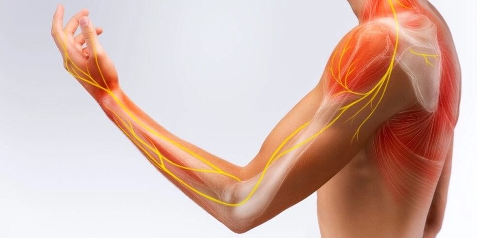 Schmerzen und Taubheitsgefühle in den Fingern weisen auf eine Bandschädigung aufgrund einer stenosierenden Ligamentitis hin